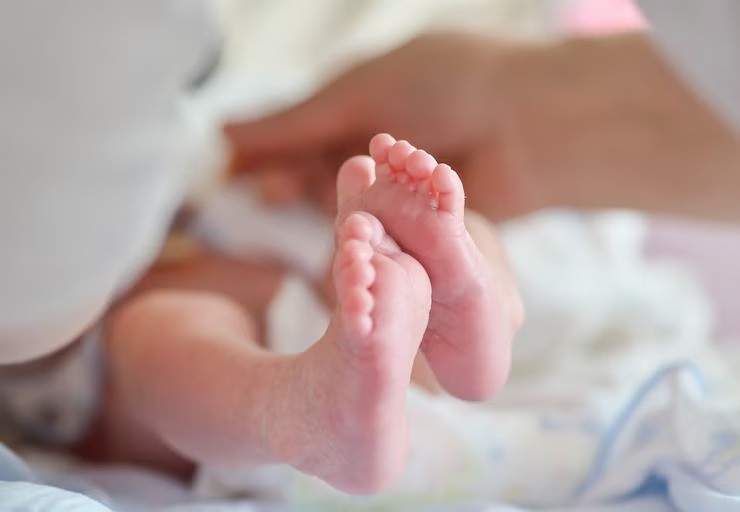 kaki bayi bengkok, kaki newborn tidak lurus, bentuk kaki bayi baru lahir, bowleg pada bayi, tumbuh kembang bayi, kaki bayi usia 3 bulan, perkembangan motorik bayi
